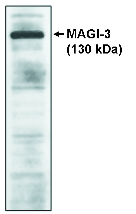 "Western blot analysis
using MAGI-3, GKWW
antibody on cell lysates
transfected with
full-length human MAGI-3
protein."